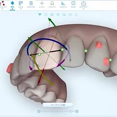 3Dスキャナーで取得した歯の3Dデータ